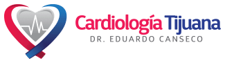 Cardiología Tijuana